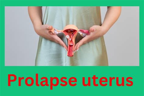 prolapso uterino humano|uterine prolapse real pictures.